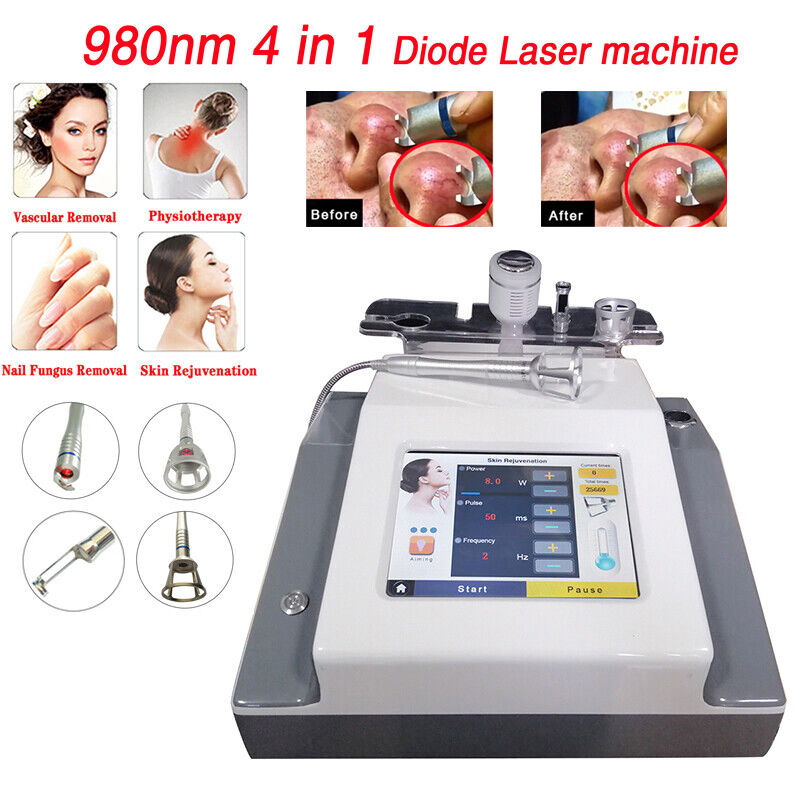 Macchina per il trattamento vascolare per la rimozione dei funghi delle unghie per fisioterapia con laser a diodi 4 in 1 980nm