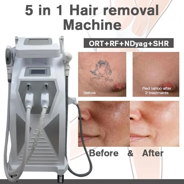 Máquina de depilación láser 4 en 1 Elight IPL HR E-Light IPL Nd Yag eliminación de tatuajes con láser rejuvenecimiento de la piel