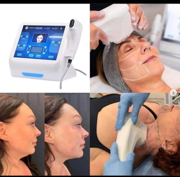 Machine de raffermissement de la peau de lifting du visage 4d HIFU, ligne portable formant une amélioration du teint de la peau, amincissement du corps HIFU à vendre avec 3 cartouches 4D (3,0 mm, 4,5 mm, 13 mm)