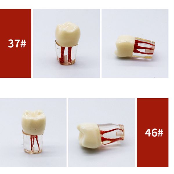 5pcs endodontique racine canal dents de dents dentaire modèle d'enseignement racine résine dents de dents en endodontie bloque la formation de la dentisterie