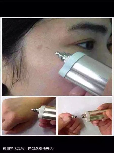 

100% good quality skin tag removal device, skin spot removal pen for beauty