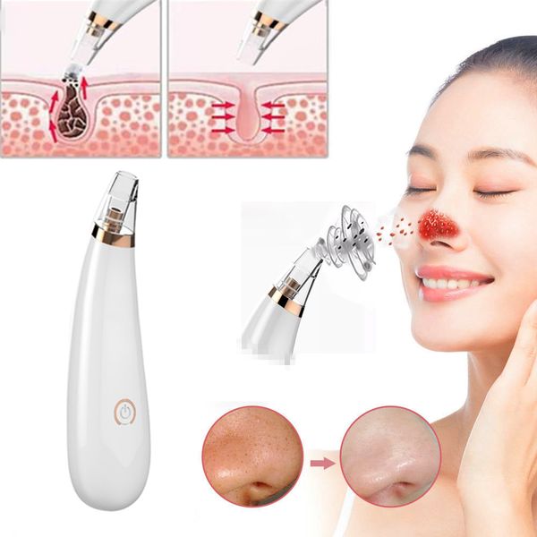 

electric facial vacuum cleaner blackhead remover face acne black dot pimple remover vacuum cleaner pore blackhead skin care tool
