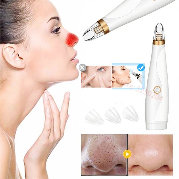 

beauty electric suction facial blackhead pore cleaning machine device for extractor nose facial cleaner blackhead removal vacuum