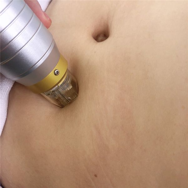 

design fractional rf microneedle machine for acne treatment skin resurfacing fractional rf microneedle scarlet device