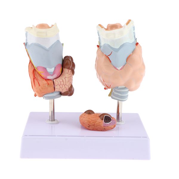 

magnified human thyroid anatomical model normal diseased with pathologies for classroom study display teaching baby play