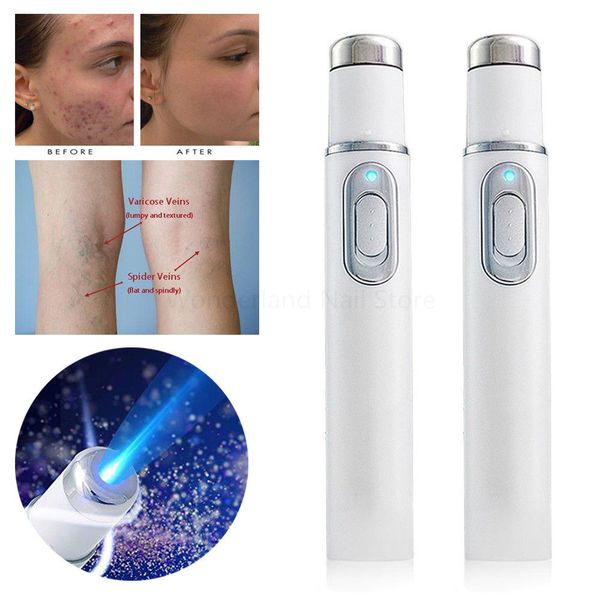 

Kd 7910 acne la er pen portable wrinkle removal machine durable oft car removal device blue light therapy pen