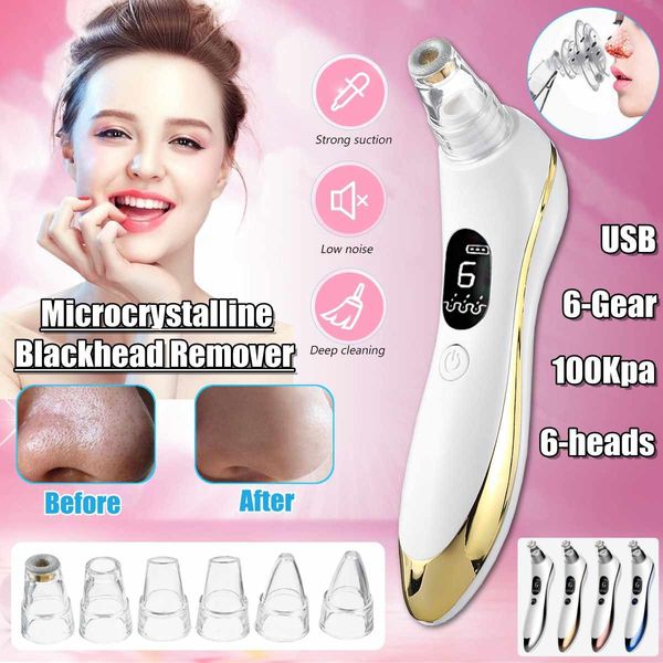 

8 in 1 electric blackhead remover facial skin pore cleaner vacuum acne cleaner