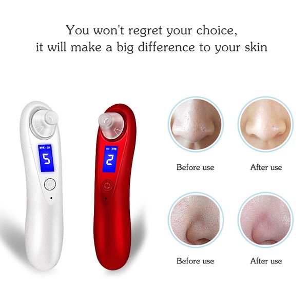 

vacuum blackhead remover suction acne remove machine electric pore cleaner pimple remover tool facial cleansing skin care tools