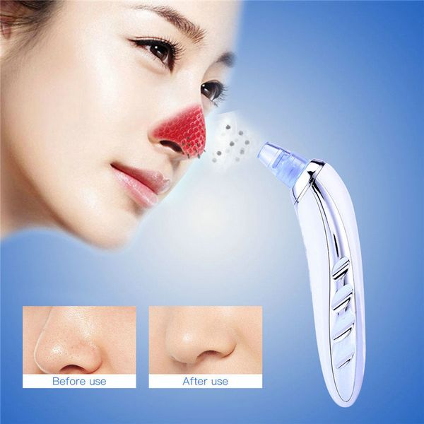 

kemei km-1868 electric portable removal blackhead rifinitore per naso brett favre skin care beauty machine byhsy