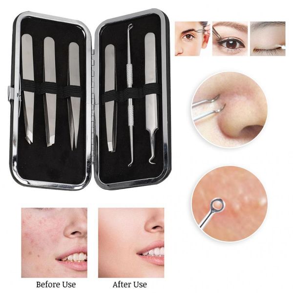 

blackhead removal 6pcs stainless steel pimples blackheads extractor tweezers needles face skin care for face cleaning