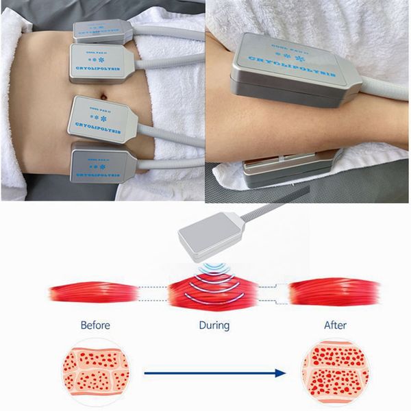 

cool pad cell slimming on body belly fat loss fat ing liposuction electric muslce stimulaiton for cellulite