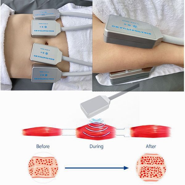 Cool Pad Cell для похудения на корпусе живота потери жира жира жир липосакция электрический мускулистый стимулировать для целлюлита