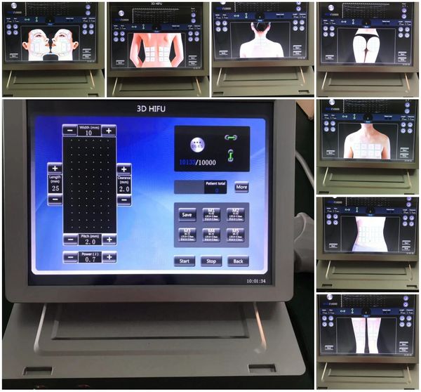 

2019 sale 3d hifu equipment focused ultrasound face lifting hifu machine ultrasound slimming beauty machine 3d hifu