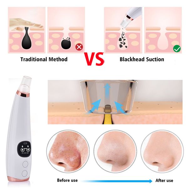 

dropshipping cleansing blackhead remover vacuum handheld electric microdermabrasion diamond dermabrasion skin pore cleansing beauty tool