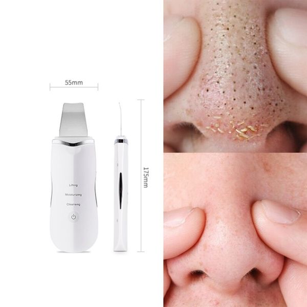 

ultrasonic skin scrubber massager machine facial pore cleaner deeply cleaning device anion face care