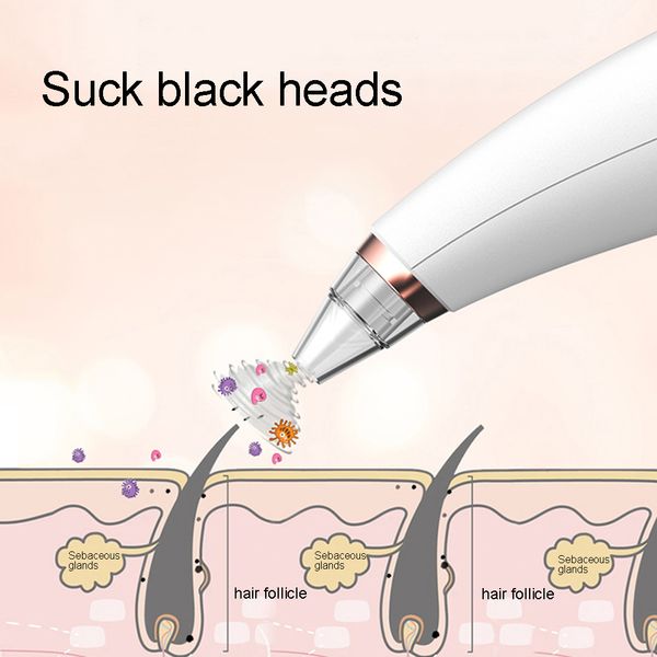 

electric pore cleaner dead skin acne blackhead remover face cleaning device removal vacuum suction facial spa beauty skin care