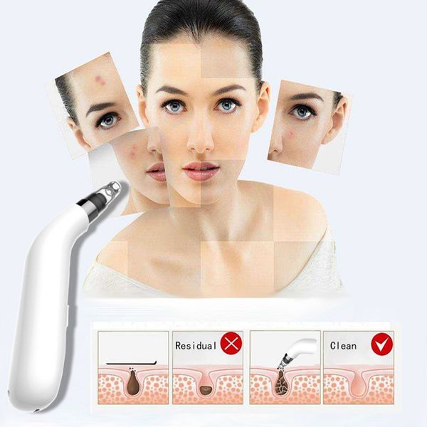 

blackhead remover vacuum rechargeable blackhead vacuum facial pore deep cleaner for blackhead acne grease wrinkles skin w0416