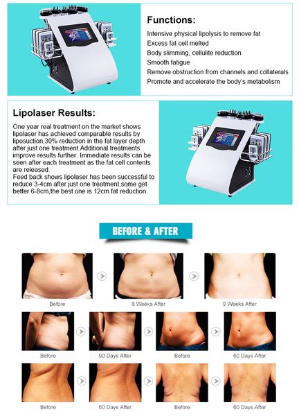 

2019 popular 6-in-140k ultrasonic liposuction air point 8-pad laser vacuum rf skin care salon slimming machine beauty equipment
