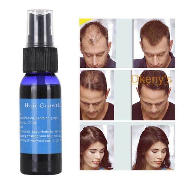 

30ml natural hair growth essence mens effective hair growth liquid ladies hair care health anti-hair loss repair essence oil