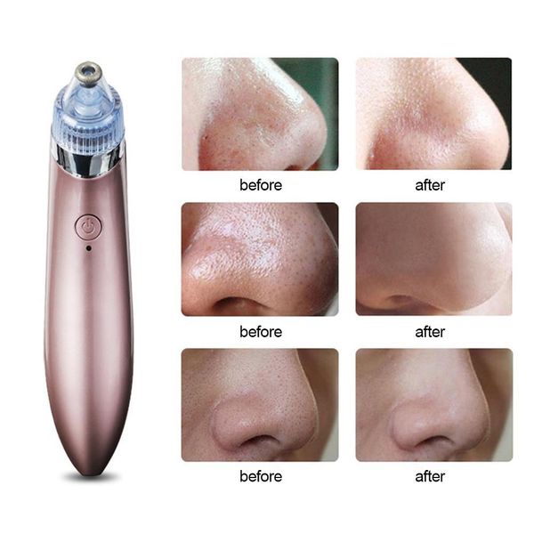 

practical pore cleaner face cleansing beauty instrument deep cleansing dead skin blackhead remover face massager skin care tools