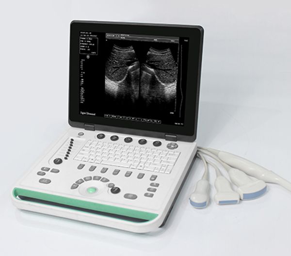 

B-ultra-som greentta