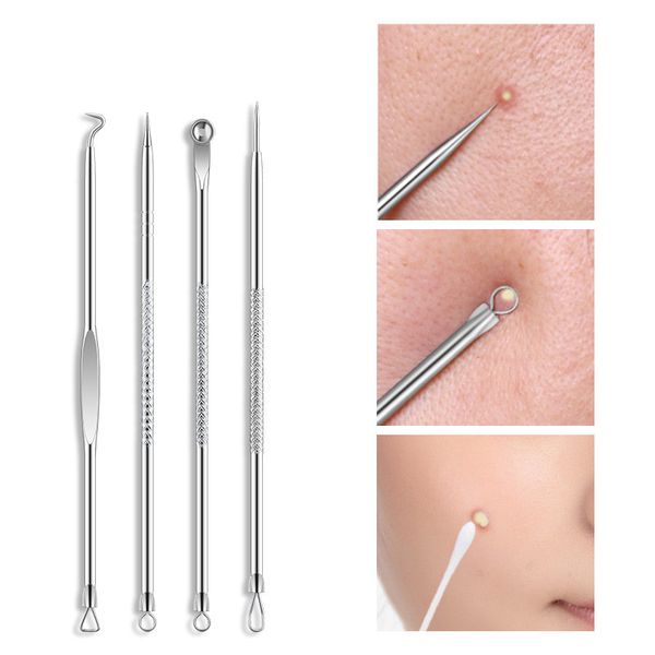 

4pcs/set stainless steel acne needle blackhead comedone acne removable blemish pimple extractor tool box packing