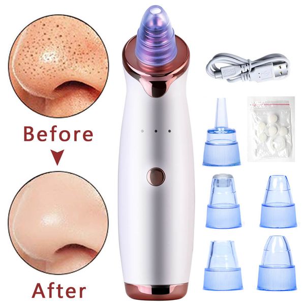 

electric facial cleanser blackhead remover deep cleaner nose black spot pore acne pimple suction rechargeable cleansing machine