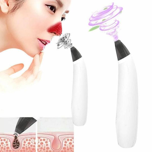 

vacuum pore blackheads aspiration acne peeling pore facial cleanser skin care facial diamond microdermabrasion beauty machine