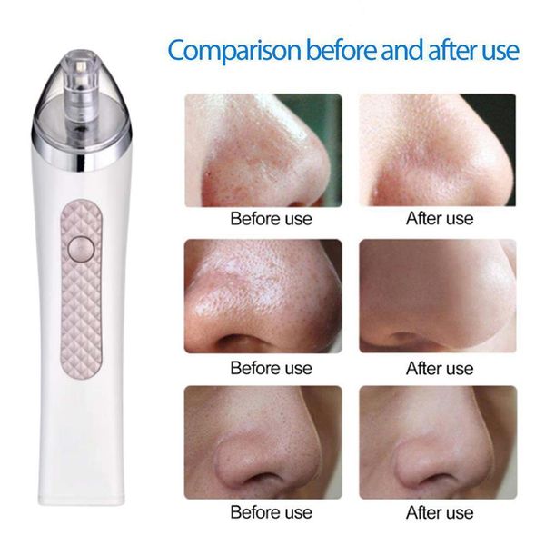 

electric blackhead acne pore remover face nose vacuum suction blackhead pimple acne remover cleaner facial skin care tool