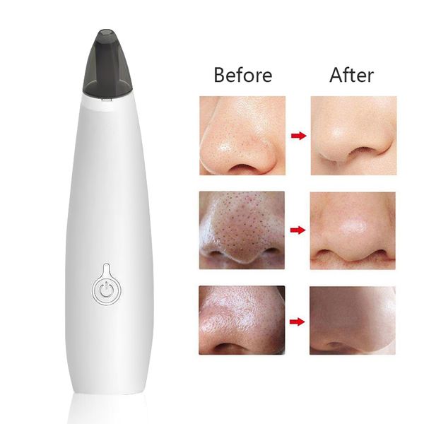 

blackhead remover face deep pore cleaner acne removal vacuum suction facial spa diamond beauty care tool skin care