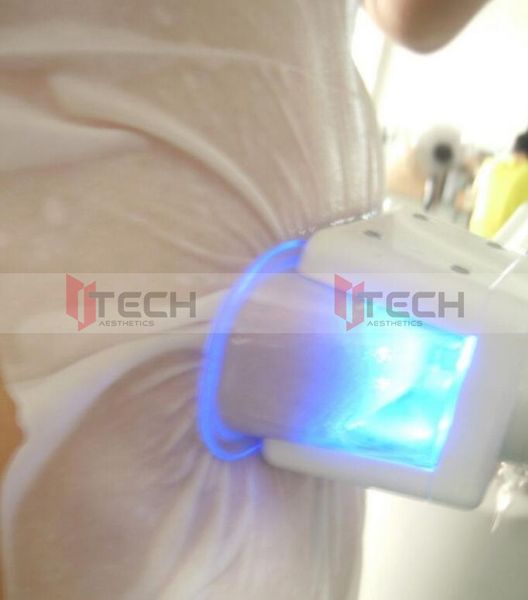 

membrane criolipolise cryolipolyse membranes cryolipolisis antie gel pad cryo pads 110g wholesale cryo mask