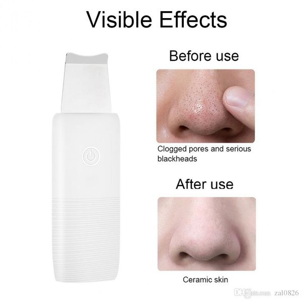 

skin scrubber blackheads removal ultrasonic deep cleansing