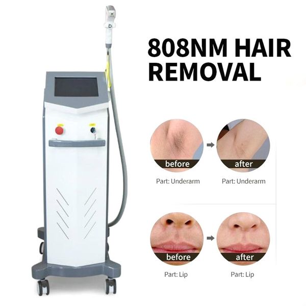 

808nm темный волосы на лице удаление устройства льда лазерный диодный лазер 808 машина кожи удаление волос омоложение лечение лазером, Black