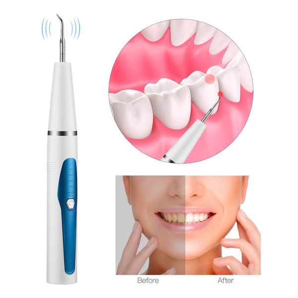 

water dental teeth cleaner toothpick tartar/plaque remover 5 modes rechargeable sonic scaler with replaceable working tips