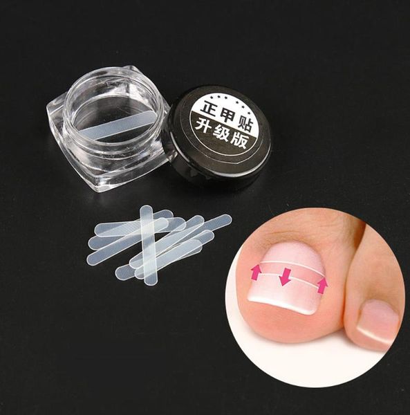 

nail files box pcs orthodontic toenail patch ingredient fixation force correction file acronyx wire corrector foot care treatment