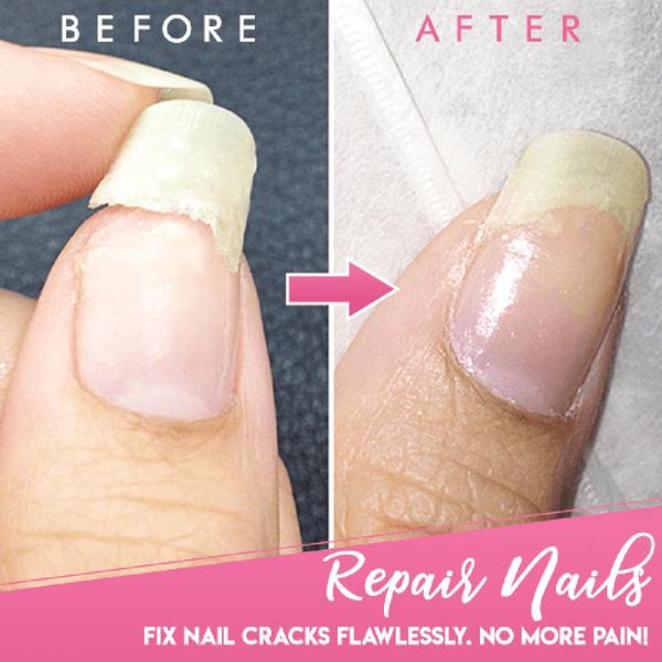 

28g magic cracked nail protector reinforce nail tips uv gel acrylic damage repair art tool tslm1, Red;pink
