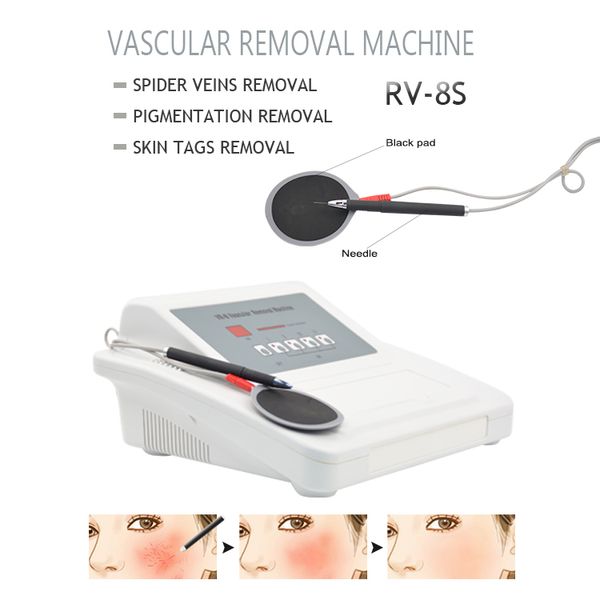 

high frequency rf needle red blood vessel removal spider veins remove vascular removal beauty salon equipment