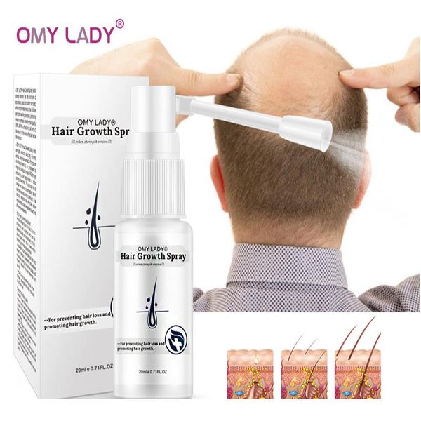 

omy lady anti hair loss hair growth spray essential oil liquid for men women dry hair regeneration repair loss wmtqkd
