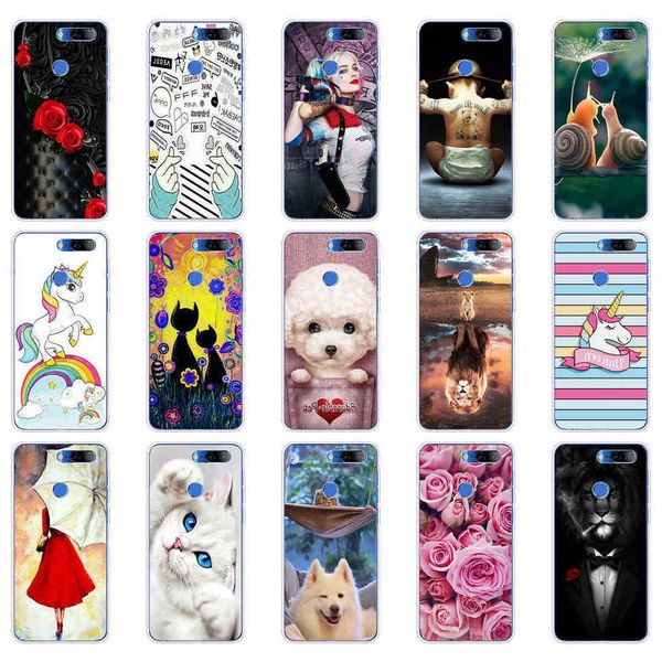 

case luxury tpu silicone cases for lenovo k9 k 9 phone back cover shells coque
