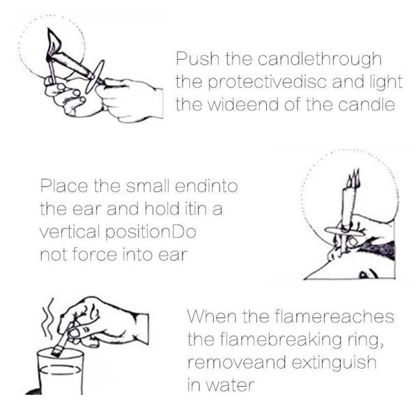 

400pcs/set ear treatmentear candle healthy care ear wax removal cleaner ear coning treatment indiana therapy fragrance jlltda