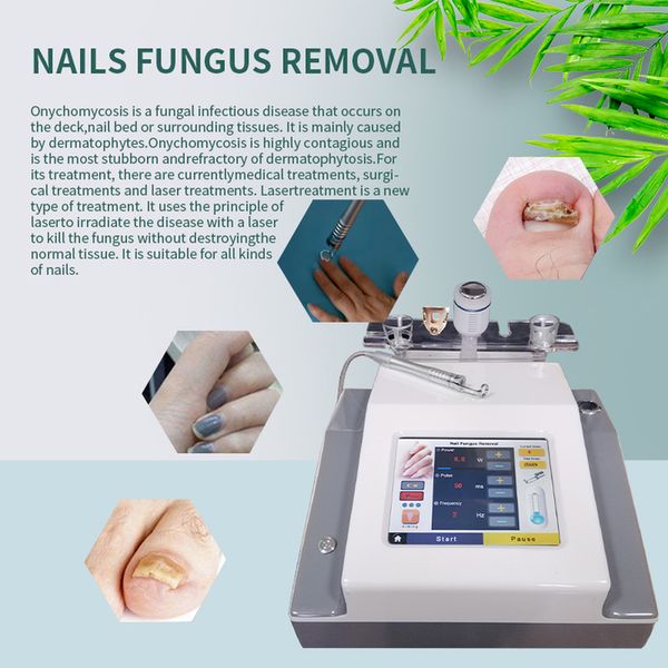 

diode laser 980nm machine nail fungus laser physical therapy equipment physiotherapy health beauty machine351, Black