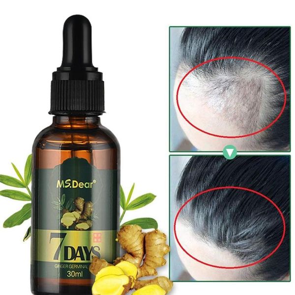 

hair growth essential oils ginger germinal oil fast hair growth anti-hair loss alopecia treatment beauty dense hair grow wmtqbh