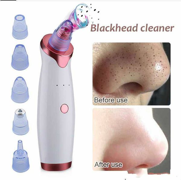 

blackhead remover pore vacuum cleaner rechargeable face vacuum comedone extractor tool for acne removal skin care with 4 suction