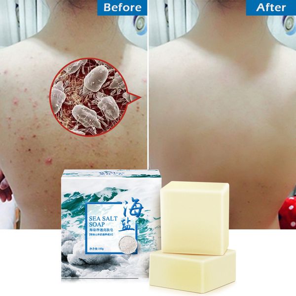 

100g removal pimple pore acne treatment sea salt soap cleaner moisturizing goat milk soap face care wash basis soap tslm1