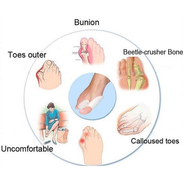 

dhl fast ship 2pcs/lot toe hallux valgus corrector sile gel spreader feet care toe separator bunion g sqcrxf babyskirt