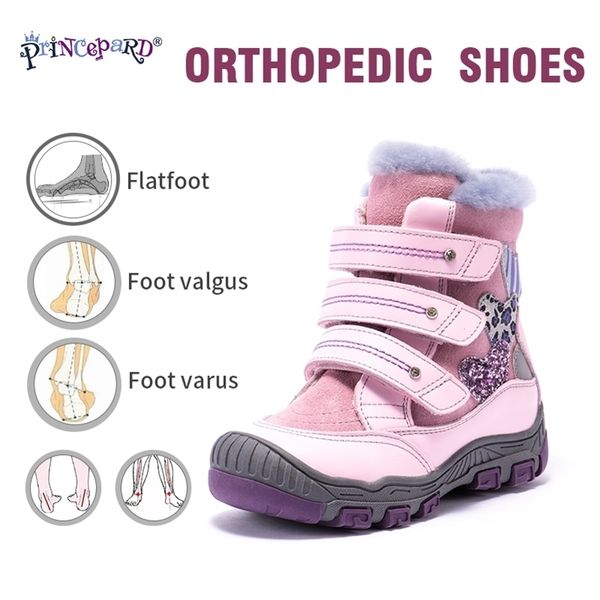

princepard 100% natural fur genuine leather orhopedic shoes for boys girls 22-36 size new winter orthopedic boots for kids lj201027, Black