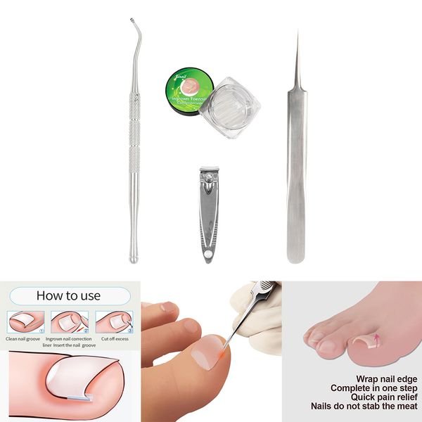 

ingrown toenail file lifters, professional safe nail treatment pedicure tool kit under nail cleaner tools pain relief