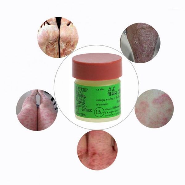 

thailand 29a natural psoriasi eczma cream works really well for eczema skin care tslm11