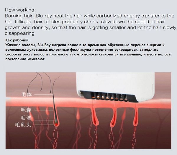 

Electric trimmer bikini lady shaver women hair removal face depilation female epilator epilation women for depilatory facial