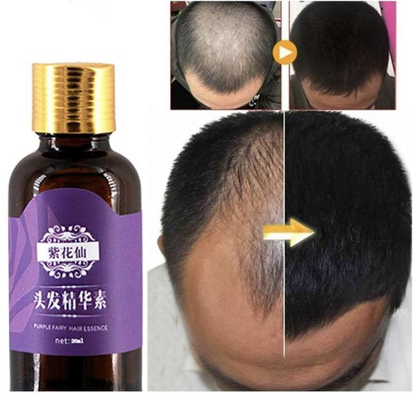 

hair loss products natural with no side effects grow hair faster regrowth hair growth wmtaxt